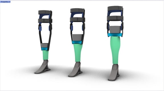 Una protesi low cost per camminare